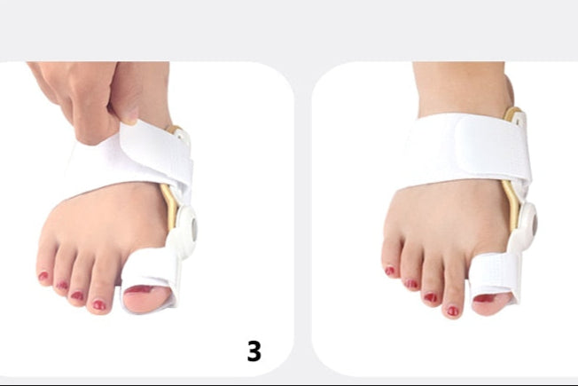 Corrector de Juanetes 2 piezas-Mayor Comodidad para los pies